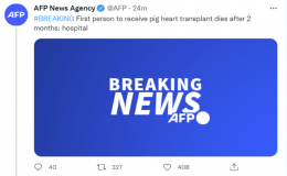 全球首例猪心脏移植患者去世